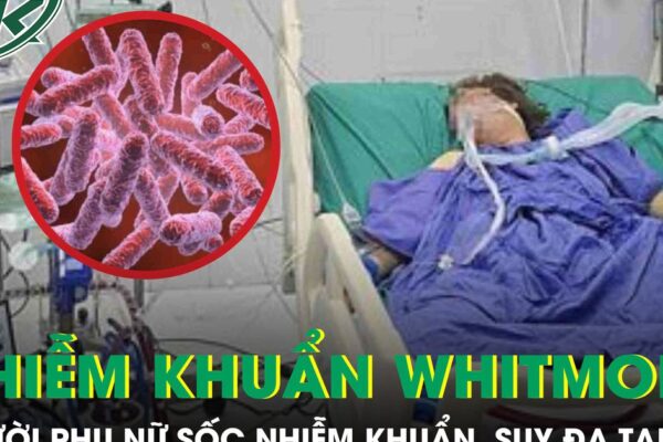 Người phụ nữ 43 tuổi sốc nhiễm khuẩn, suy đa tạng sau 5 ngày sốt