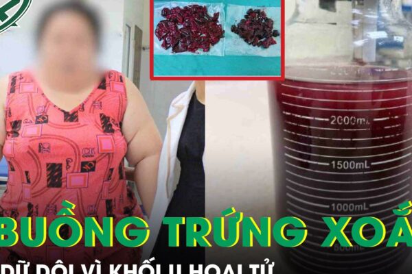Cô gái nặng 120kg đau bụng dữ dội vì hoại tử khối u buồng trứng xoắn 20cm