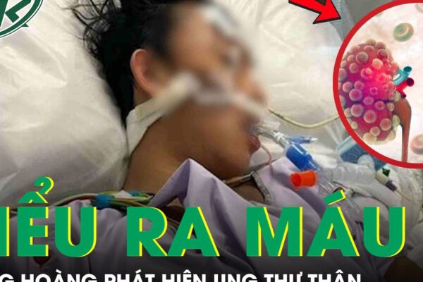 Người đàn ông 51 tuổi bàng hoàng phát hiện ung thư thận từ dấu hiệu tiểu ra máu