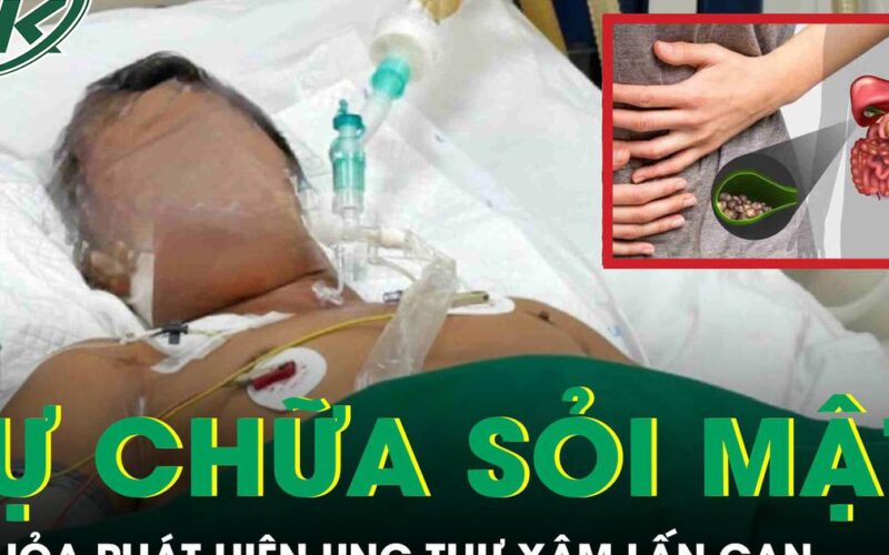 Tự chữa sỏi mật tại nhà, người đàn ông tá hỏa phát hiện ung thư xâm lấn gan